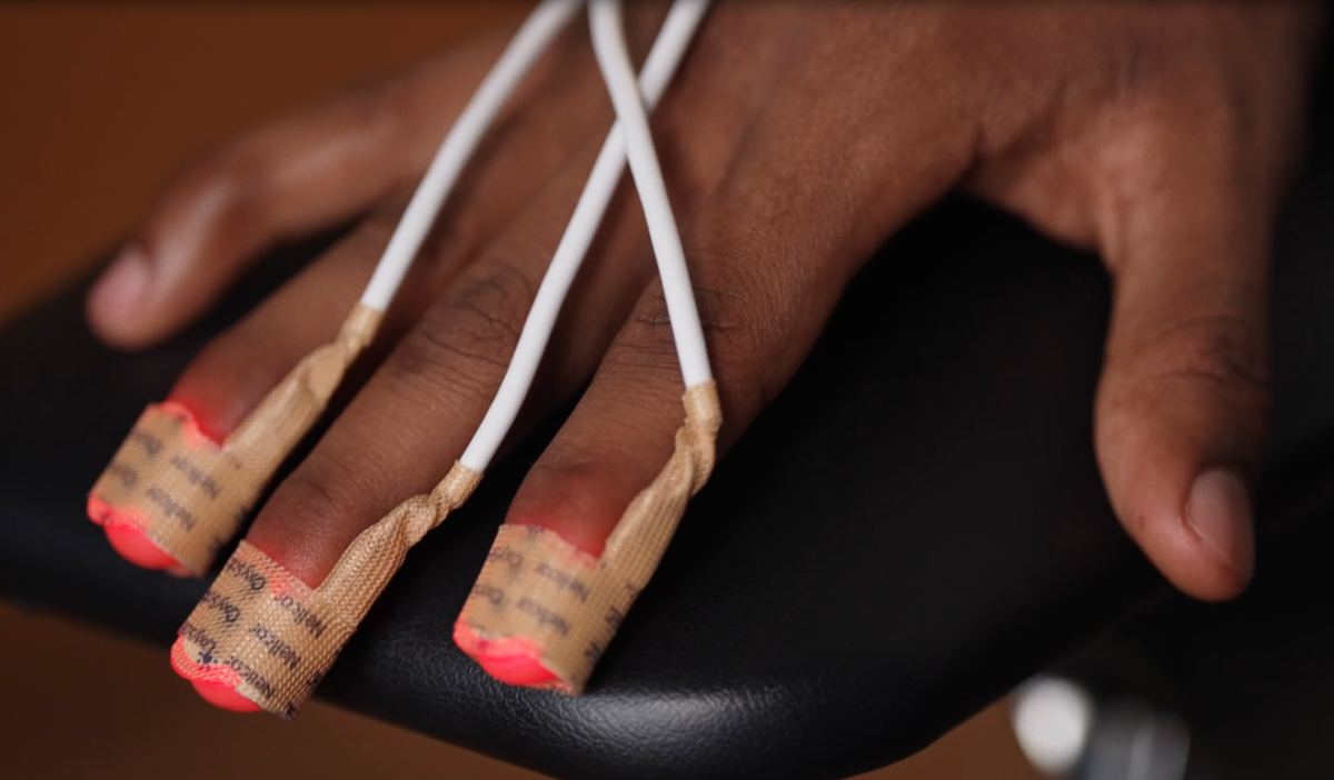 Image of a patient's hand connected to a Medtronic pulse oximeter